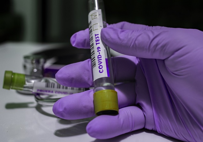Israel desarrolla más anticuerpos que neutralizan el coronavirus